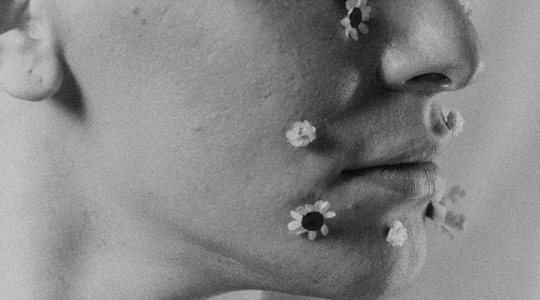 Microbiome Skincare for Acne-Prone Skin: Why Harsh Treatments Are Making Your Breakouts Worse — and What Alkylo Organics Does Differently